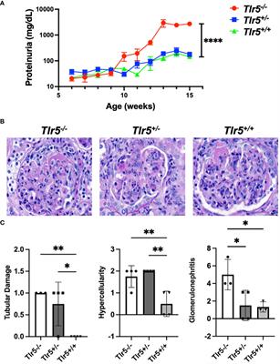 Tlr5 deficiency exacerbates lupus-like disease in the MRL/lpr mouse model
